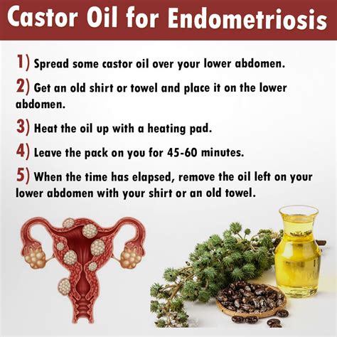 endometriosis pain relief home remedies